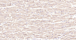 Cardiac Troponin I Antibody in Immunohistochemistry (Paraffin) (IHC (P))