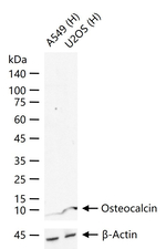 Osteocalcin Monoclonal Antibody (7A2)