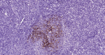 CD23 Antibody in Immunohistochemistry (Paraffin) (IHC (P))