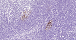 CD23 Monoclonal Antibody (2F10)