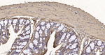 beta Actin Antibody in Immunohistochemistry (Paraffin) (IHC (P))