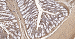 beta Actin Antibody in Immunohistochemistry (Paraffin) (IHC (P))