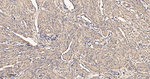 beta Actin Antibody in Immunohistochemistry (Paraffin) (IHC (P))