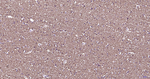 beta Tubulin Antibody in Immunohistochemistry (Paraffin) (IHC (P))