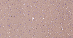 beta Tubulin Antibody in Immunohistochemistry (Paraffin) (IHC (P))
