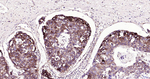 beta Tubulin Antibody in Immunohistochemistry (Paraffin) (IHC (P))