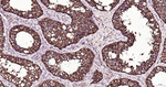 beta Tubulin Antibody in Immunohistochemistry (Paraffin) (IHC (P))