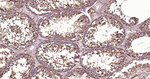 beta Tubulin Antibody in Immunohistochemistry (Paraffin) (IHC (P))