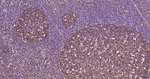 beta Tubulin Antibody in Immunohistochemistry (Paraffin) (IHC (P))