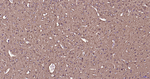 beta Tubulin Antibody in Immunohistochemistry (Paraffin) (IHC (P))