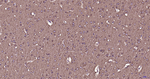 beta Tubulin Antibody in Immunohistochemistry (Paraffin) (IHC (P))