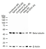 beta Tubulin Antibody in Western Blot (WB)