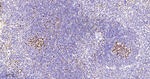 PCNA Antibody in Immunohistochemistry (Paraffin) (IHC (P))
