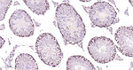 PCNA Antibody in Immunohistochemistry (Paraffin) (IHC (P))
