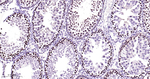 PCNA Antibody in Immunohistochemistry (Paraffin) (IHC (P))