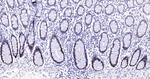 PCNA Antibody in Immunohistochemistry (Paraffin) (IHC (P))