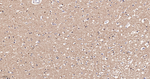 alpha Tubulin Antibody in Immunohistochemistry (Paraffin) (IHC (P))