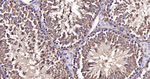 alpha Tubulin Antibody in Immunohistochemistry (Paraffin) (IHC (P))