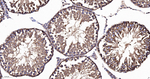alpha Tubulin Antibody in Immunohistochemistry (Paraffin) (IHC (P))