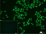 TUBB1 Recombinant Rabbit Monoclonal Antibody (5F7)