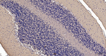 TUBB1 Antibody in Immunohistochemistry (Paraffin) (IHC (P))