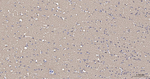 TUBB1 Antibody in Immunohistochemistry (Paraffin) (IHC (P))