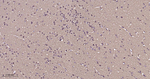 TUBB1 Antibody in Immunohistochemistry (Paraffin) (IHC (P))