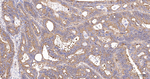TUBB1 Antibody in Immunohistochemistry (Paraffin) (IHC (P))