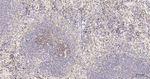 TUBB1 Antibody in Immunohistochemistry (Paraffin) (IHC (P))