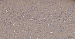TUBB1 Antibody in Immunohistochemistry (Paraffin) (IHC (P))