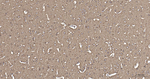 TUBB1 Antibody in Immunohistochemistry (Paraffin) (IHC (P))