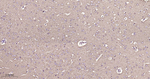 TUBB1 Antibody in Immunohistochemistry (Paraffin) (IHC (P))