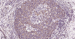 TUBB1 Antibody in Immunohistochemistry (Paraffin) (IHC (P))