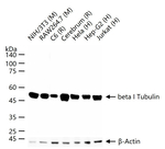 TUBB1 Antibody in Western Blot (WB)