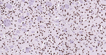 Histone H3 Antibody in Immunohistochemistry (Paraffin) (IHC (P))