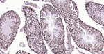 Histone H3 Antibody in Immunohistochemistry (Paraffin) (IHC (P))