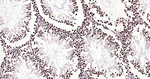 Histone H3 Antibody in Immunohistochemistry (Paraffin) (IHC (P))
