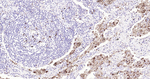 CD68 Antibody in Immunohistochemistry (Paraffin) (IHC (P))