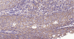 ABCB5 Antibody in Immunohistochemistry (Paraffin) (IHC (P))