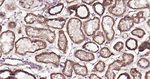ABCB5 Antibody in Immunohistochemistry (Paraffin) (IHC (P))