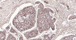 ABCB5 Monoclonal Antibody (11B4)