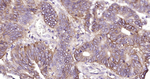 Carbonic Anhydrase IX Monoclonal Antibody (5H10)