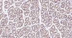 Carbonic Anhydrase IX Antibody in Immunohistochemistry (Paraffin) (IHC (P))