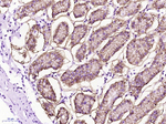 Carbonic Anhydrase IX Antibody in Immunohistochemistry (Paraffin) (IHC (P))
