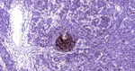 CD23 Antibody in Immunohistochemistry (Paraffin) (IHC (P))