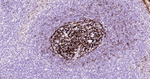CD23 Antibody in Immunohistochemistry (Paraffin) (IHC (P))