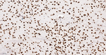 H3K79me1 Antibody in Immunohistochemistry (Paraffin) (IHC (P))
