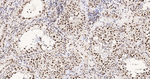 H3K79me1 Antibody in Immunohistochemistry (Paraffin) (IHC (P))