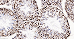 H3K79me1 Antibody in Immunohistochemistry (Paraffin) (IHC (P))
