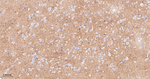 FUT4 Antibody in Immunohistochemistry (Paraffin) (IHC (P))